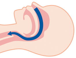 閉塞していない正常な喉の状態